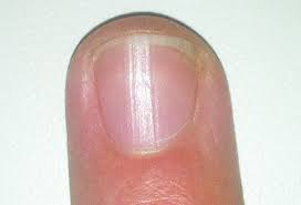 fingernail